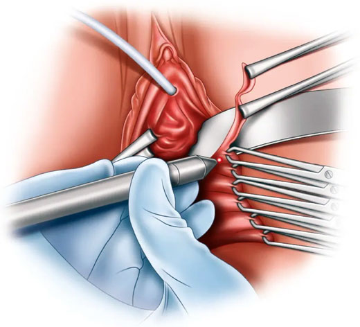 Cirug&iacute;a &iacute;ntima femenina