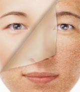 Horas despu�s de estar expuesta al sol, los rayos ultravioletas siguen da�ando la piel 