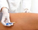 6 y 7 de abril: curso de actualizaci�n en mesoterapia biol�gica